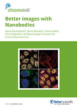 Bessere Bilder mit Nanobodies
